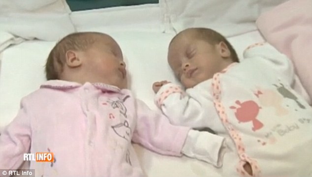 معجزة ولادة طفلتين توأم بفارق شهرين !