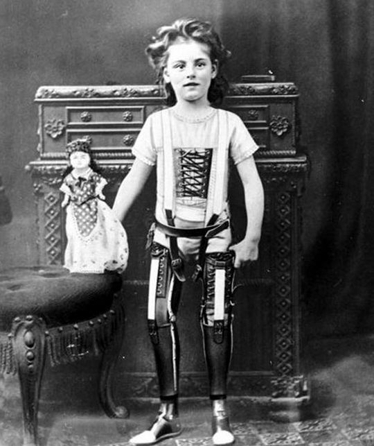 ساقين اصطناعيتين، المملكة المتحدة، كاليفورنيا. 1890