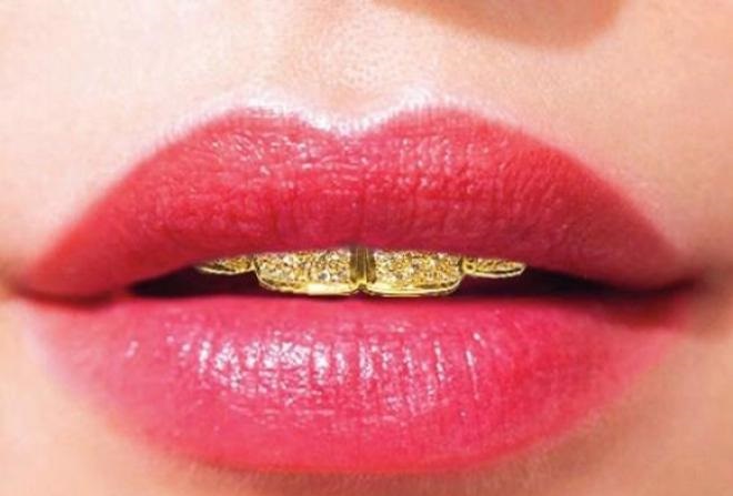 اسنان من الذهب