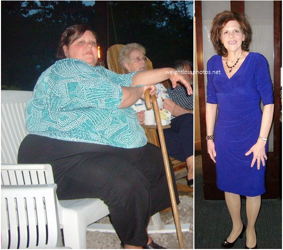 before-and-after-weight-loss (3)
