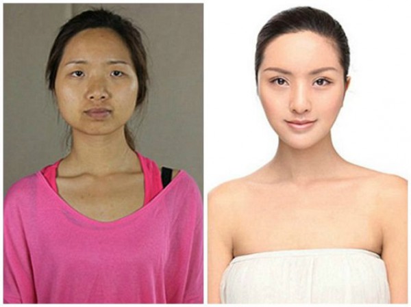 قبل و بعد عمليات التجميل