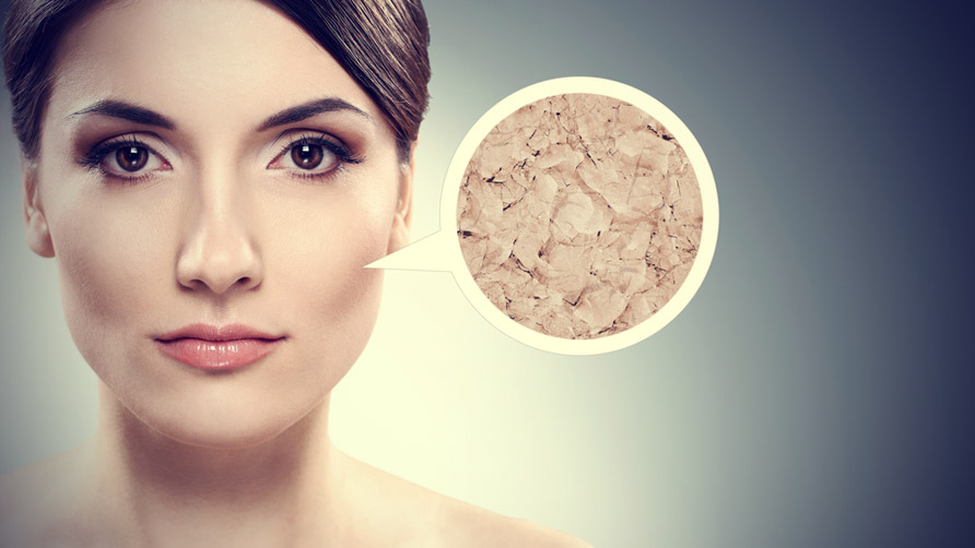 6-Effective-Ways-How-to-Treat-Excessively-Dry-Skin