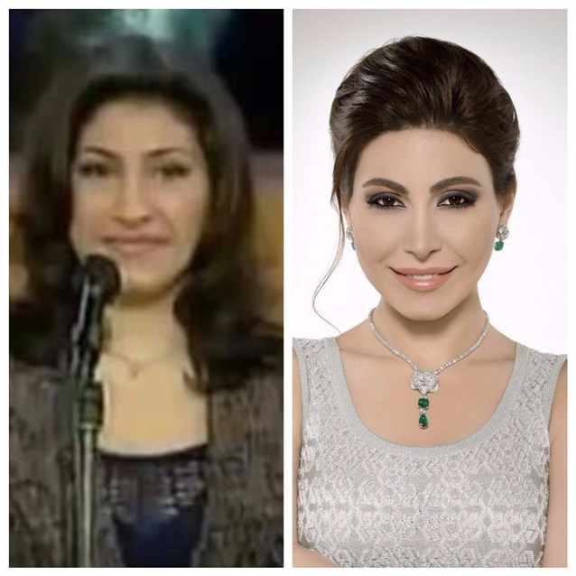 يارا فنانة اللبنانية تغير شكلها مع الشهرة شاهديها قبل وبعد عمليات التجميل
