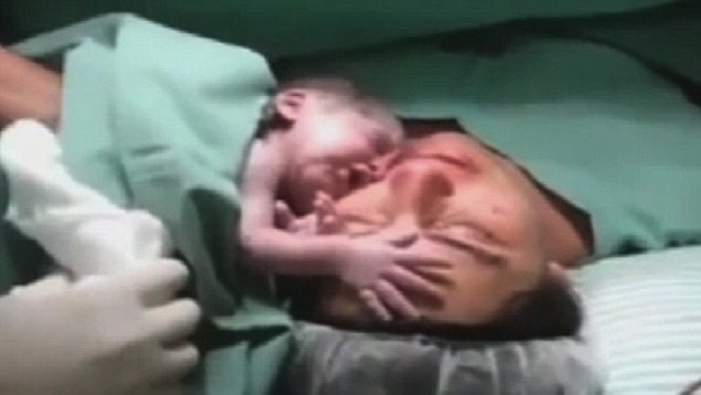 فيديو مؤثر لرضيع يرفض الابتعاد عن أمه بعد ولادته مباشرة 