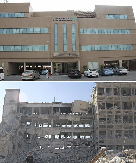 مستشفى الكندي في حلب.. الصورة الاولى من العام 2012 والثانية من 2013.