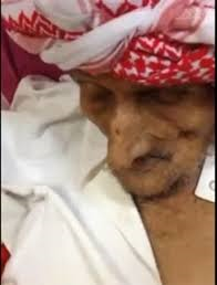 فيديو لسعودي يبلغ من العمر 137 عاماً غارق بغيبوبة ولا يقوم الا للأذان 